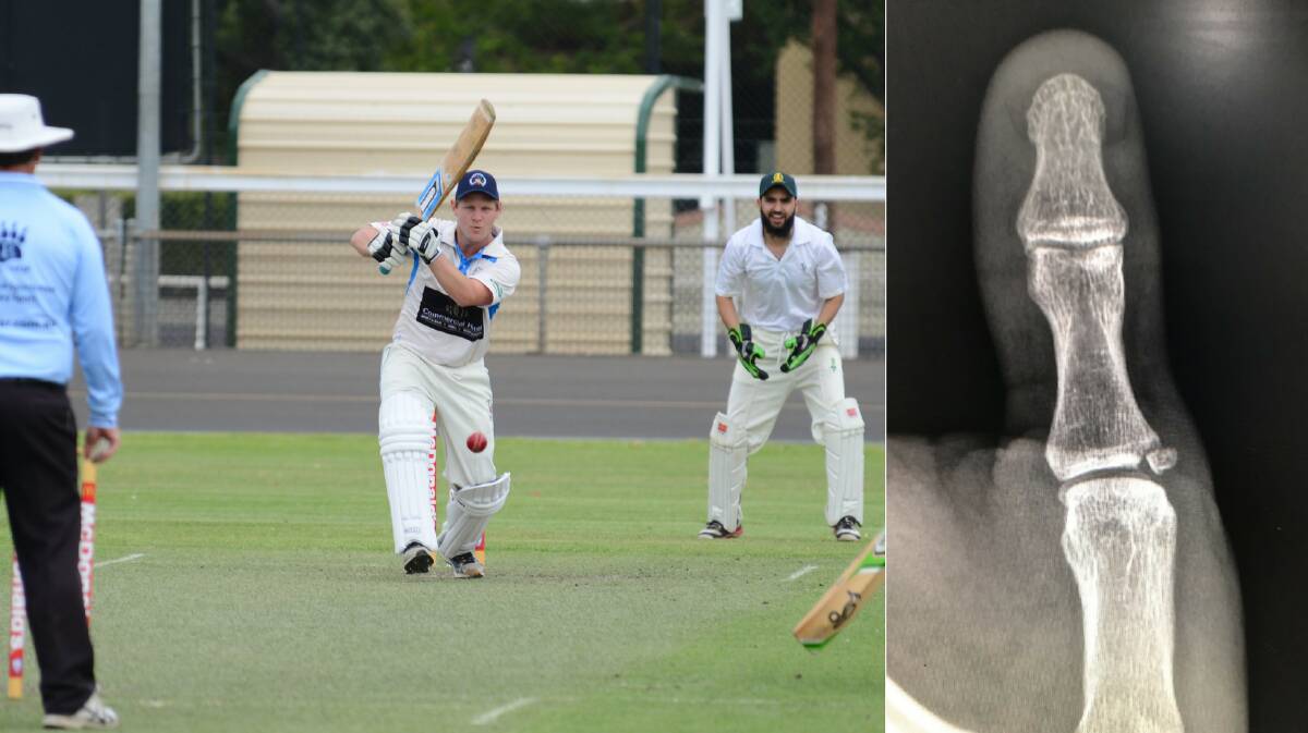INJURED: Jordan Moran and an X-ray of the broken thumb (right) he suffered during Sunday's match.