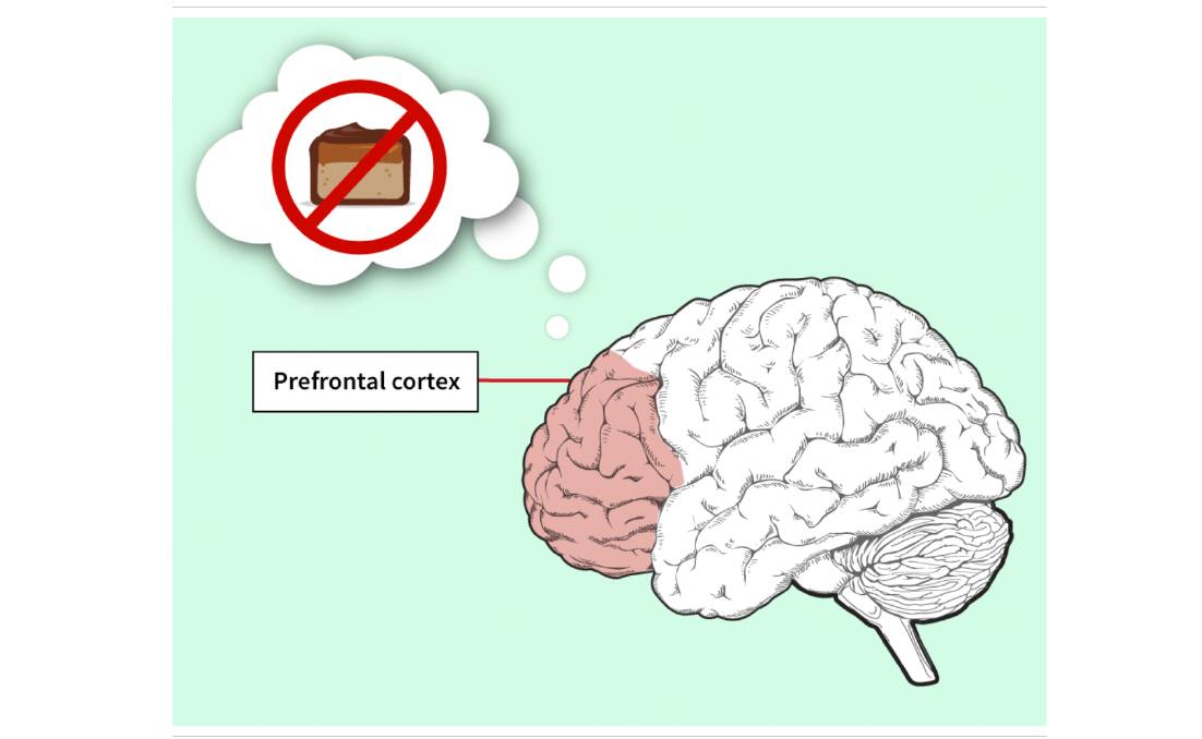 The prefrontal cortex acts as the brain's “brakes” but it's weakened by too much sugar (and fat). Image: THE AGE