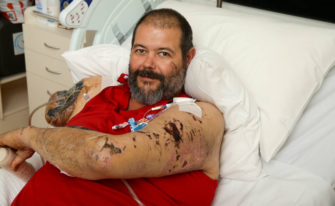 Dog attack: Mechanic Brendan Clark was working on a Coonamble property when he was mauled by two large dogs. Photo: Jonathan Carroll.