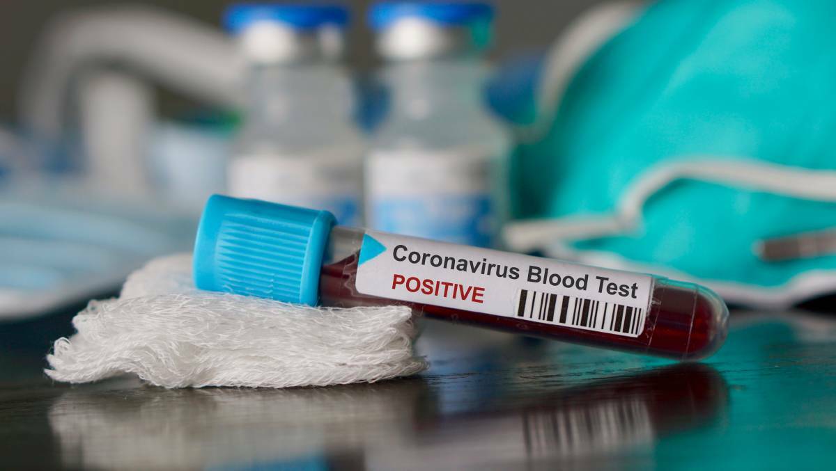 DIRECTION: People concerned they may have the coronavirus can seek direction by calling the National Coronavirus Helpline on 1800 020 080 or Health Direct on 1800 022 222. Photo: File