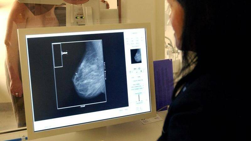 PRIORITY: Dubbo women who had mammograms cancelled due to the temporary suspension of BreastScreen services are now being contacted "as a priority". Photo: FILE.