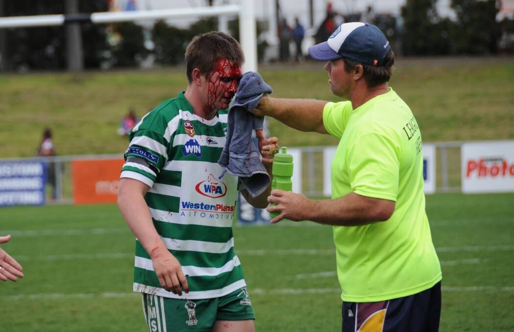 TOUGH: The 2016 grand final was a bruising affair, as shown by the injury sustained by CYMS' Ben Marlin. Photo: FILE