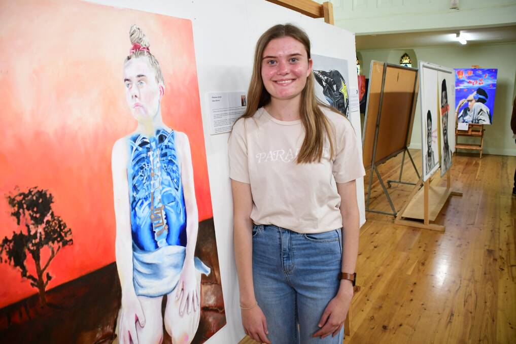 STORIES BEHIND SCARS: Abbey MacLeod with her artwork 'Precious Scars'. Photo: AMY McINTYRE. 
