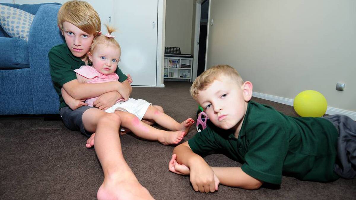Milla Campion, 16 months, with her brothers Brock, 9, and Aiden, 5. | Photo: Louise Donges. WARNING: The following photos of Milla's burns are quite graphic and may upset some readers..