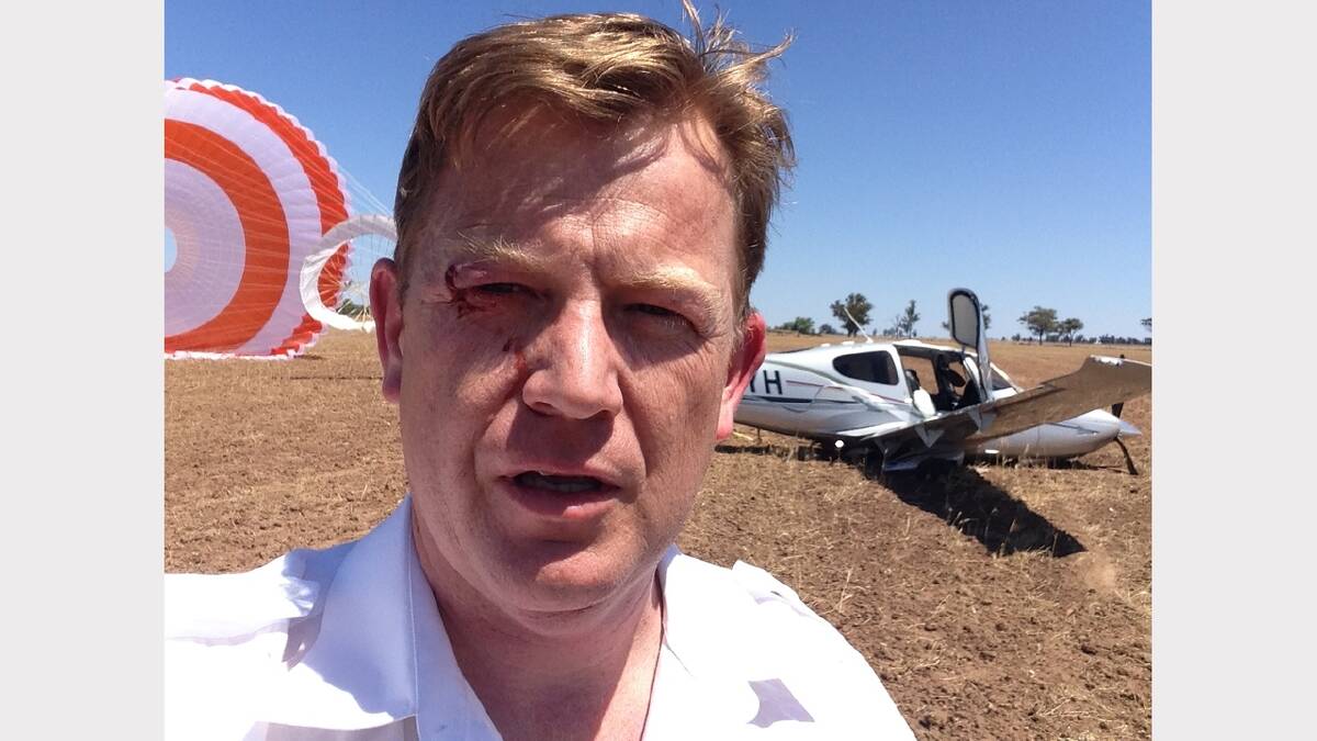 Dubbo's John Nixon was bruised and shaken after piloting the light aircraft safely to the ground. 							   Mobile phone photo: John Nixon